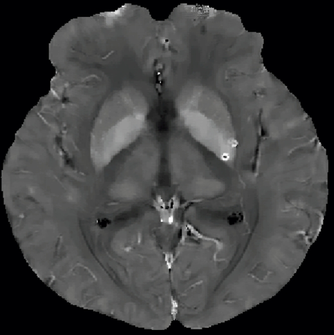 Figure 2c: