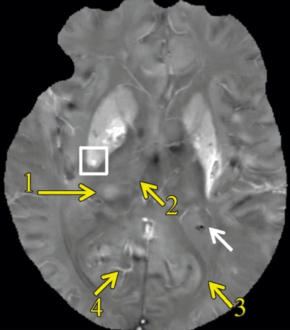 Figure 5b: