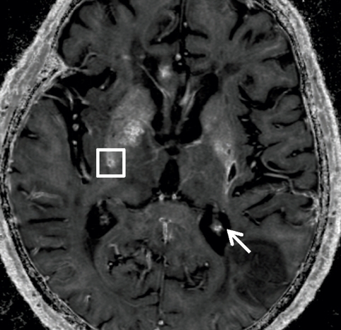 Figure 5a: