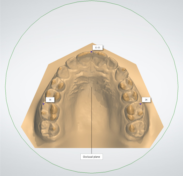 Fig. 2