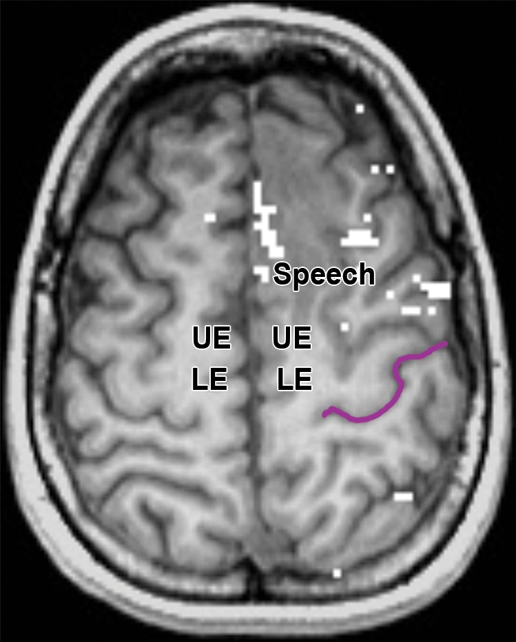 Figure 2c