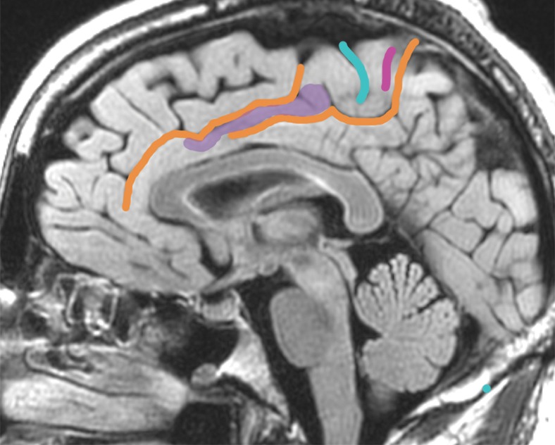 Figure 3b