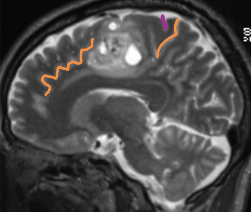 Figure 4b