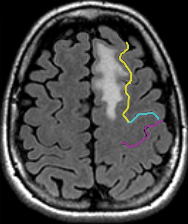 Figure 2a