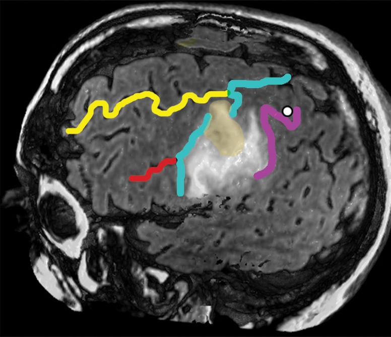 Figure 13b