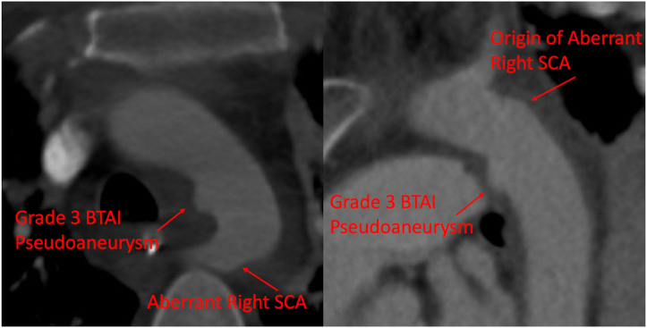 Fig 1