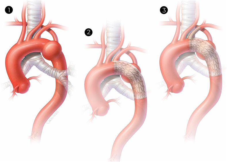 Fig 2