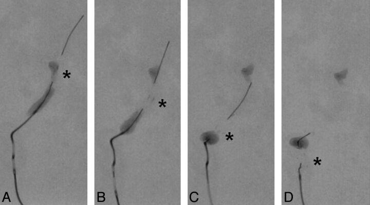 Fig 4.