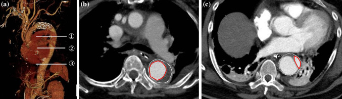 Fig. 1