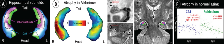 Fig.1