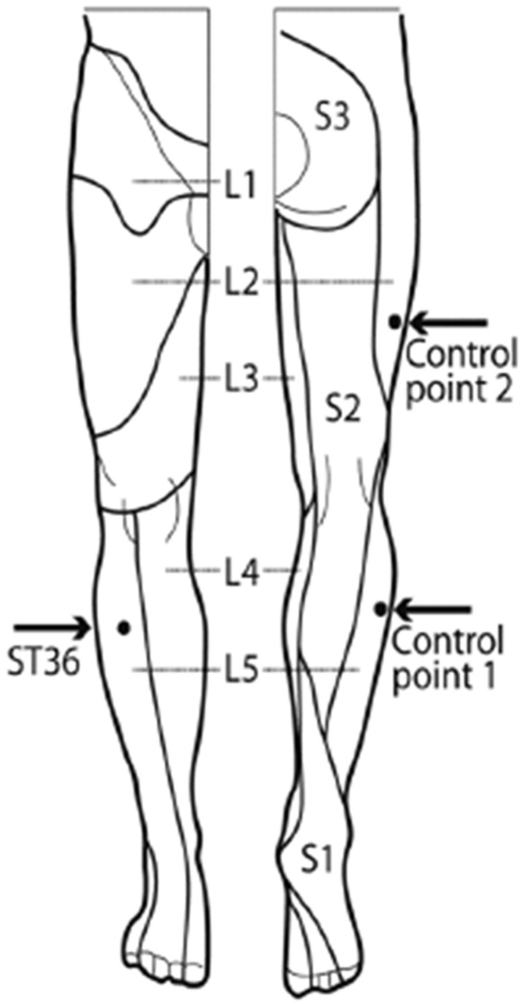 FIGURE 1