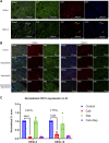 Figure 3. Immunofluorescence staining for tumor cells and vasculature in PDX lines RESL5 and RESL10. A, Representative IF images of untreated tumor samples stained with anti-CA9 antibody (green), anti-Ki67 antibody (red), and DAPI (blue) for PDX lines RESL5 and RESL10. Scale bars, 100 μm. B, Representative immunofluorescent images of tumor samples stained with anti-CD31 antibody (red) and anti-CA9 antibody (green) in mice treated with vehicle, cabozantinib, sapanisertib, and the combination (cabozantinib plus sapanisertib) in PDX lines RESL5 and RESL10. Three independent experiments were performed with similar results. Scale bars, 100 μm. C, Bar plot showing the normalized CD31 expression from immunofluorescent images for mice treated with vehicle, cabozantinib, sapanisertib, and the combination in PDX lines RESL5 and RESL10. ****, P < 0.0001 using Student t test.