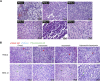 Figure 2. H&E images for the PDX models. A, Representative H&E images for the six PDX models. B, Representative H&E images for tumors in mice treated with vehicle, cabozantinib, sapanisertib, and the combination (cabozantinib plus sapanisertib) in PDX lines RESL5 and RESL10. Red arrows, clear cells; green arrows, sarcomatoid cells; blue arrows, vessels.