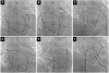 Fig. 9
