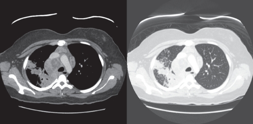 Figure 1)