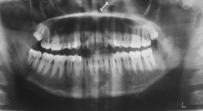 Fig. 13
