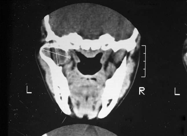 Fig. 4