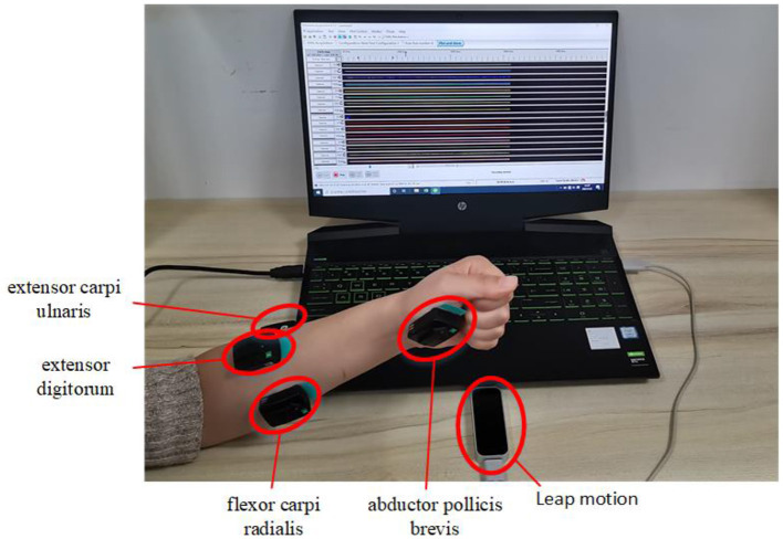 Figure 2