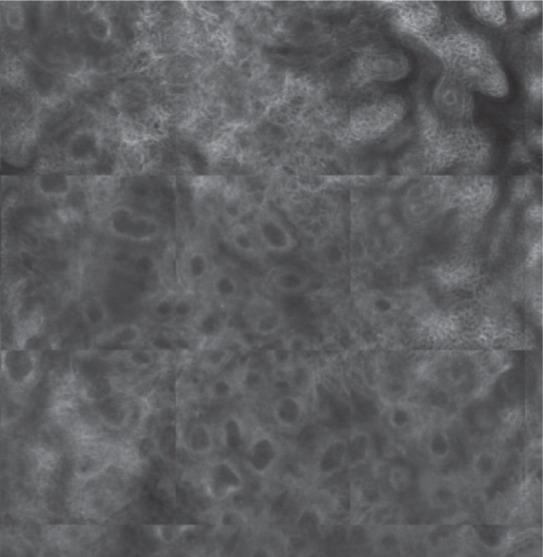 Figure 3 D: