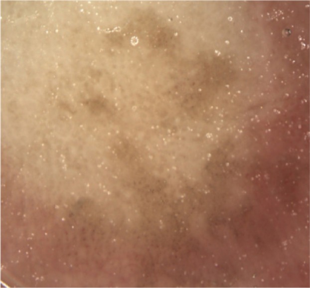 Figure 2 B: