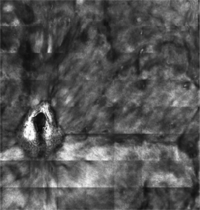 Figure 1 C: