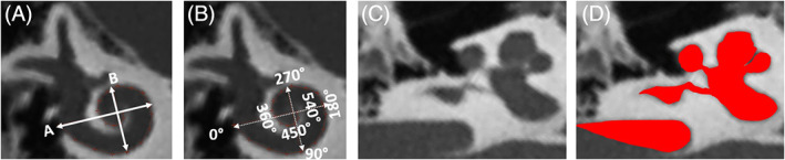 FIGURE 1