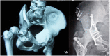 Fig. 3