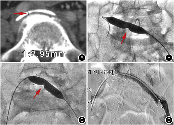 Fig. 2