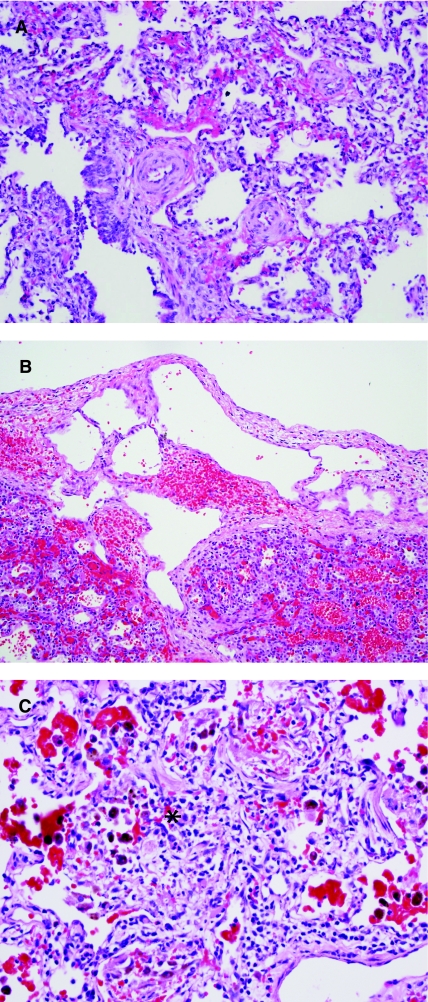 FIG. 14.