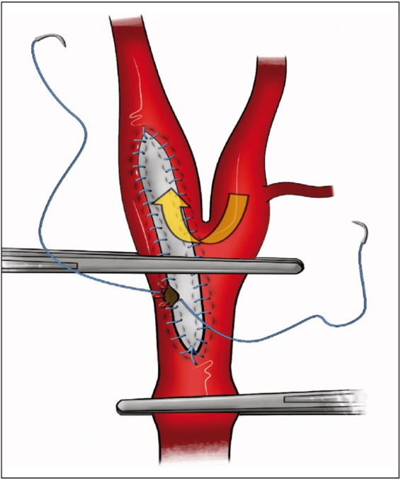 Figure 9