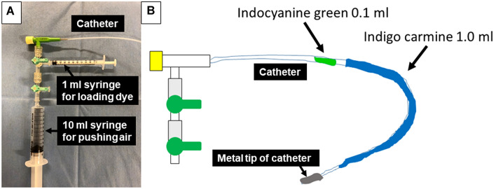 Fig. 1