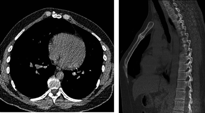Figure 13.