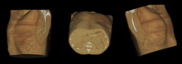 Figure 15.