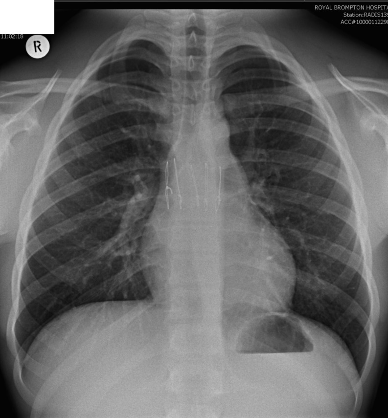 Figure 11.