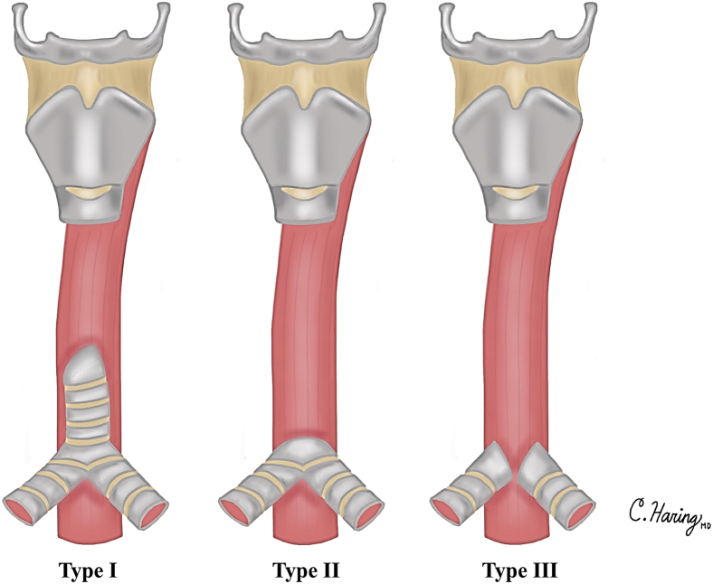 Figure E1