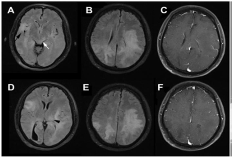 Fig. 5