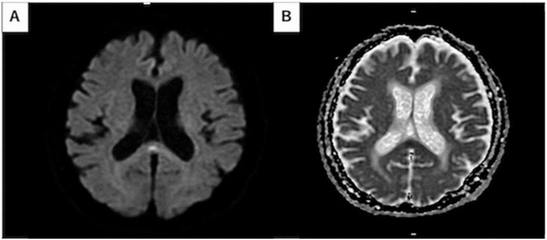 Fig. 7