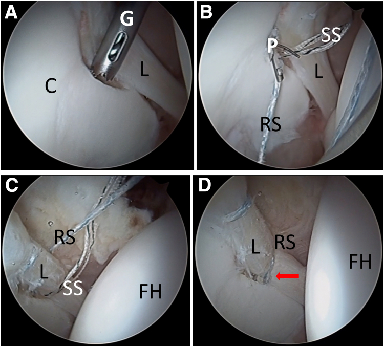 Fig 3