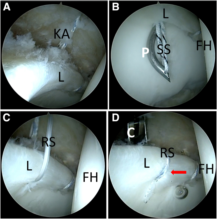 Fig 2