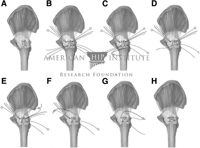 Fig 4