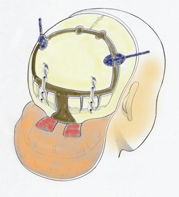 Fig. 1.