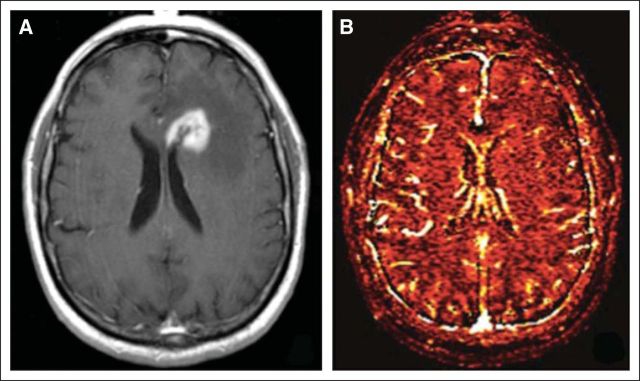 Fig 4.