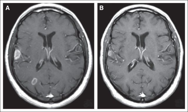 Fig 3.