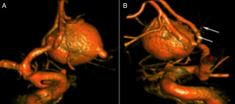 Figure 3