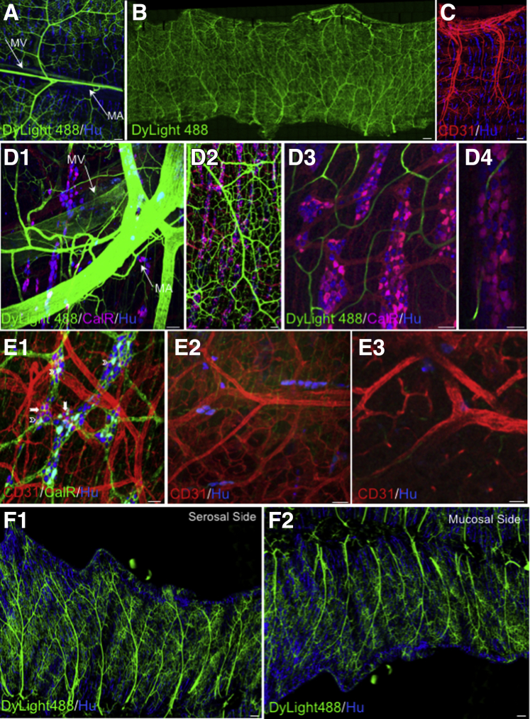 Figure 13