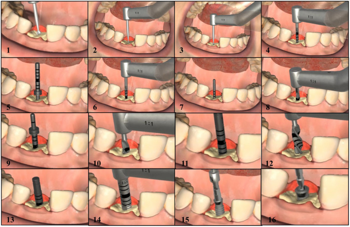 Figure 11