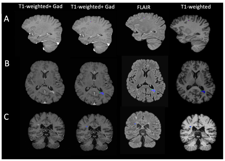 Figure 3