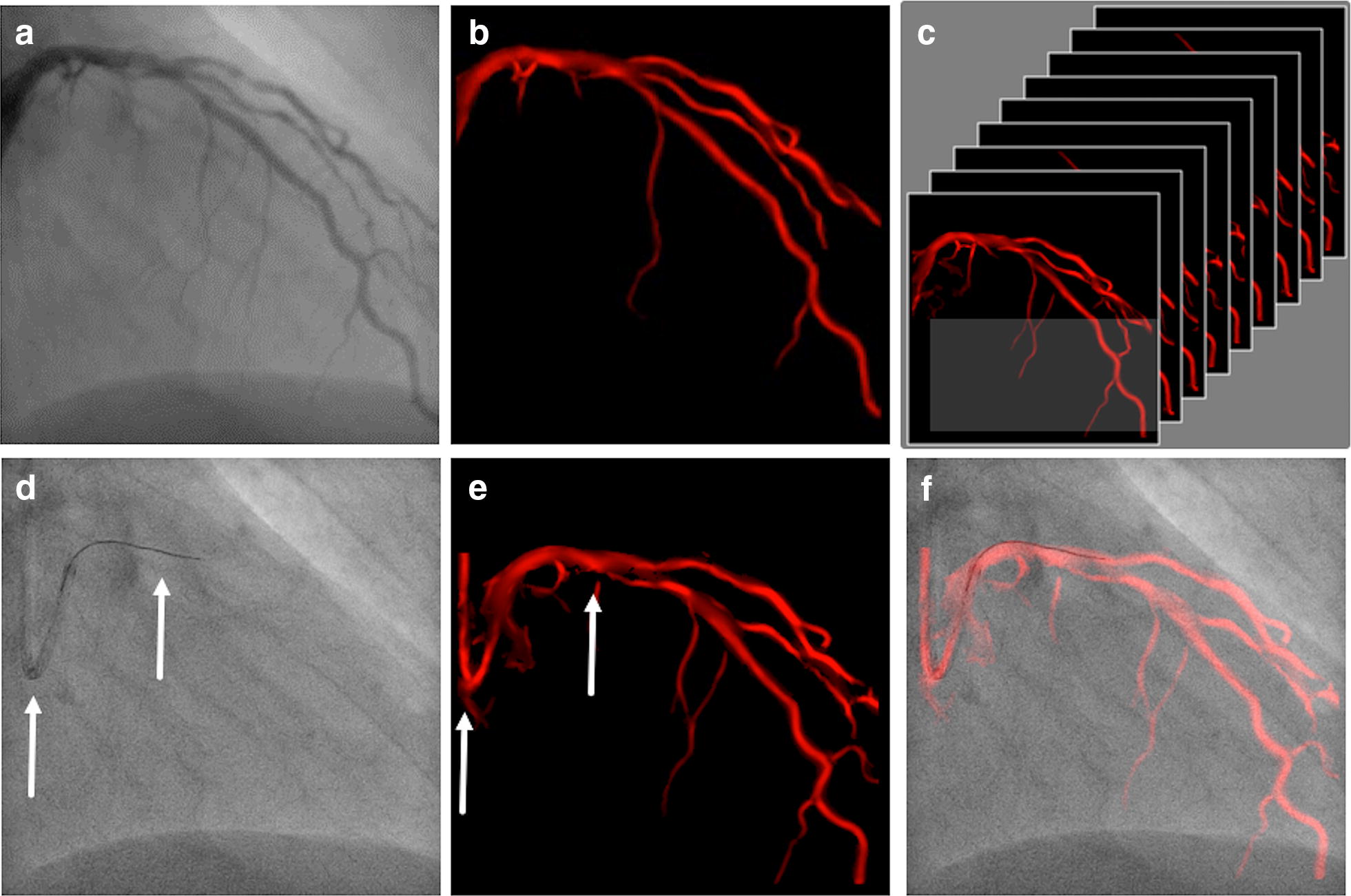 Fig. 1