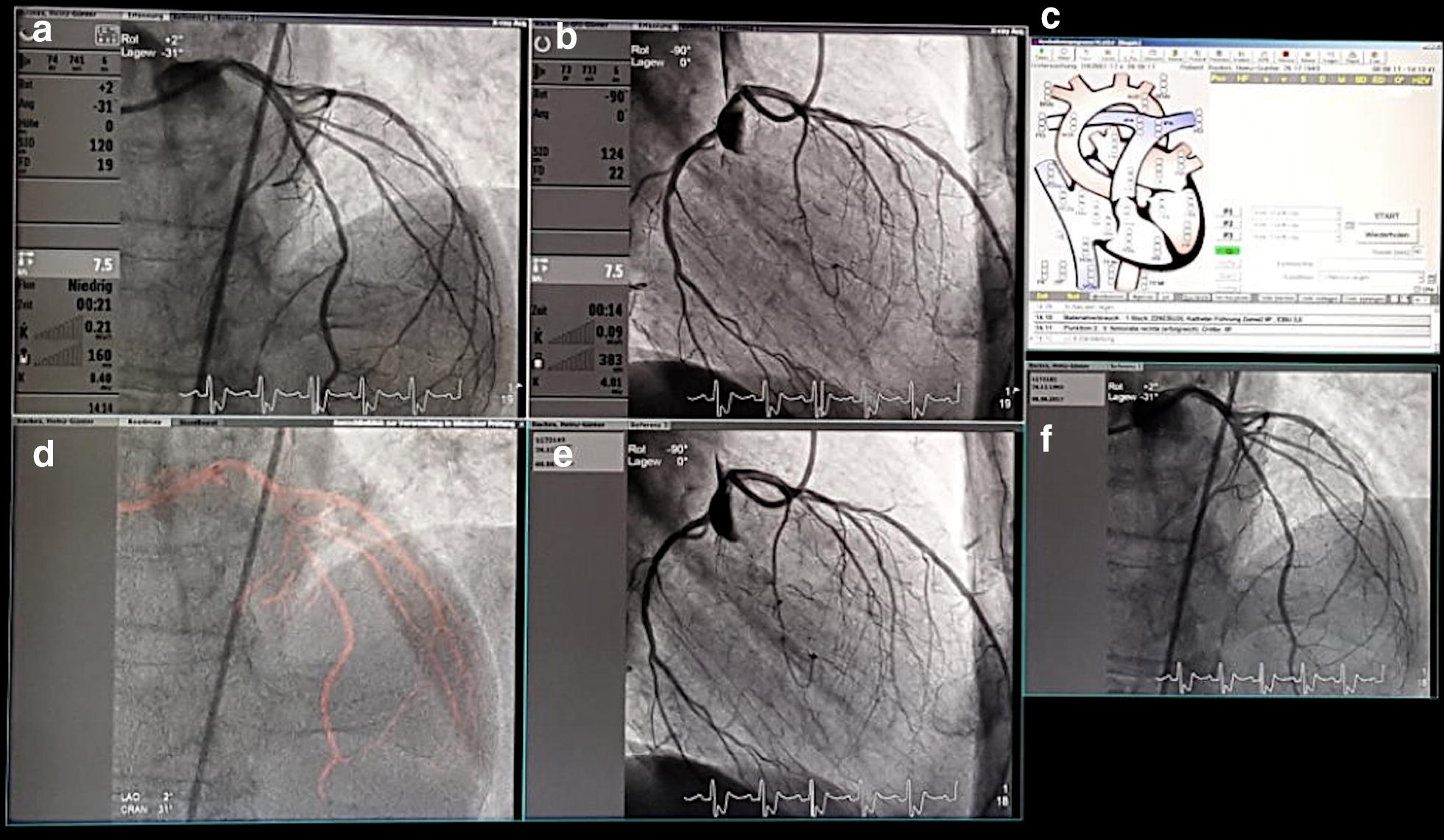 Fig. 2