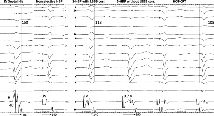 Figure 3